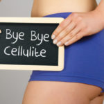 cellulite-cause-rimedi