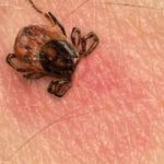 Zecche e malattia di Lyme