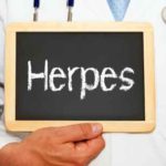 herpes sintomi rimedi naturali