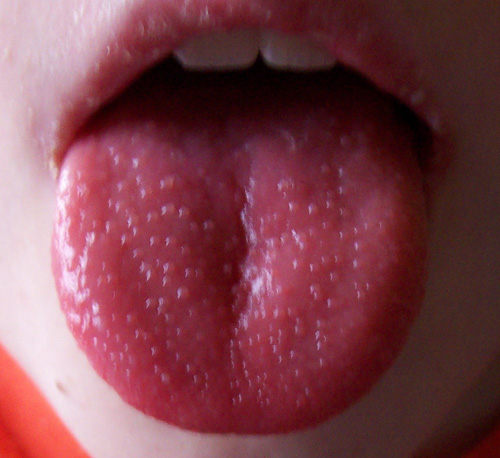 lingua fragola rossa