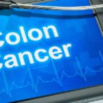 Cancro colon retto