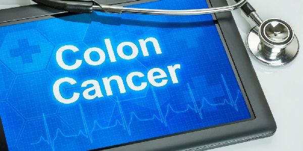 Cancro colon retto
