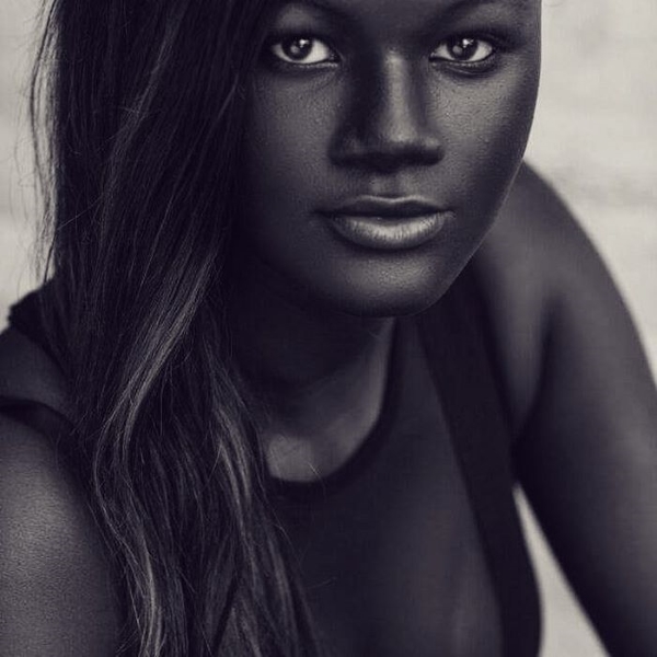 donna scura melanina4