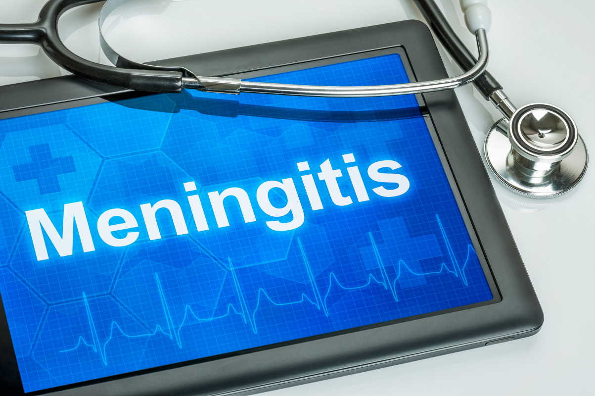meningite