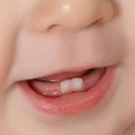 denti-neonati