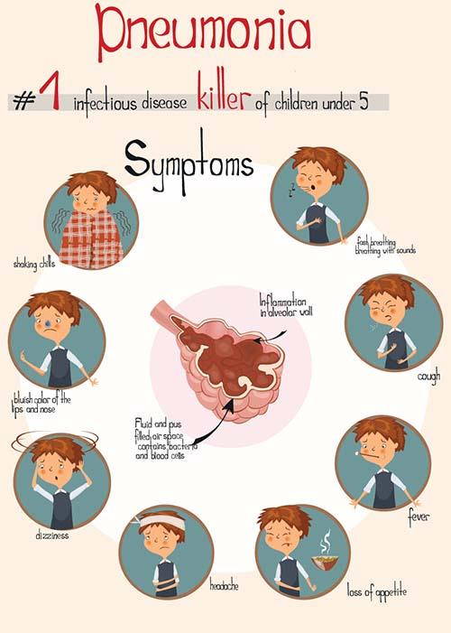 polmonite sintomi