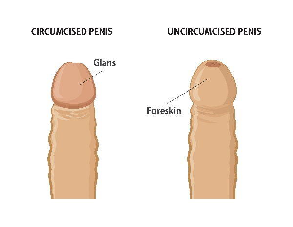 circoncisione