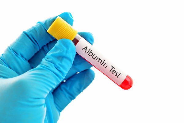 albumina test