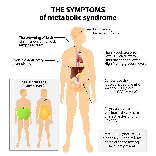 sindrome met sintomi