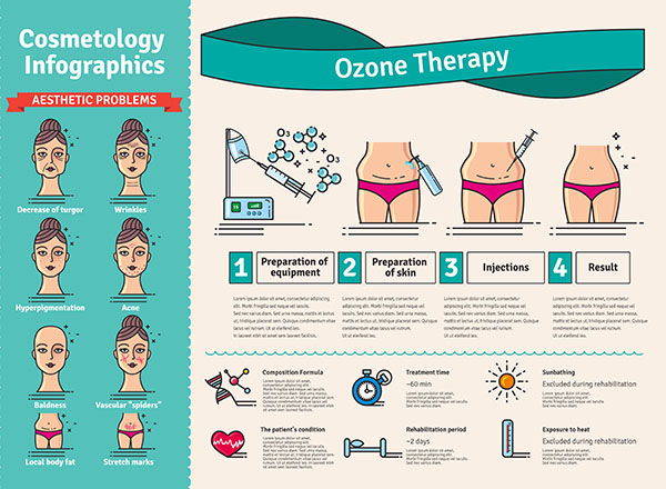 ozonoterapia infografica