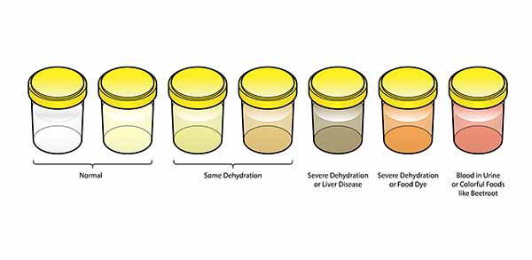 urina colori infografica