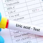 acido urico