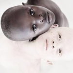 bambini_albini