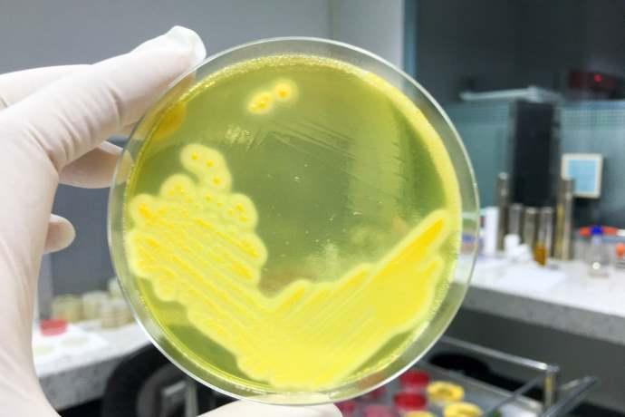 Ecco Il Probiotico In Grado Di Uccidere I Batteri Restistenti Agli Antibiotici Greenme [ 460 x 690 Pixel ]