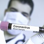 coronavirus test molecolare