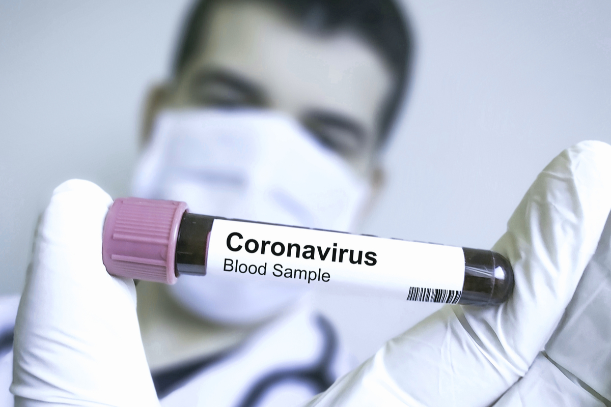 coronavirus test molecolare