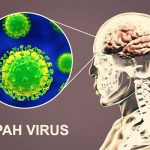 virus nipah