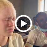 albinismo africa