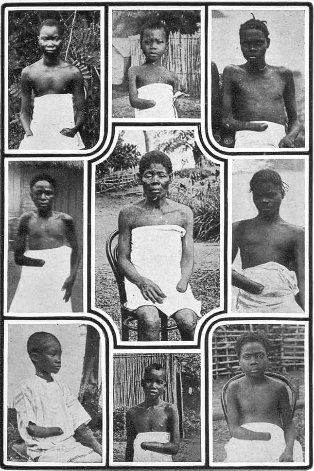 Foto di bimbi congolesi mutilati
