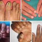 salute delle unghie