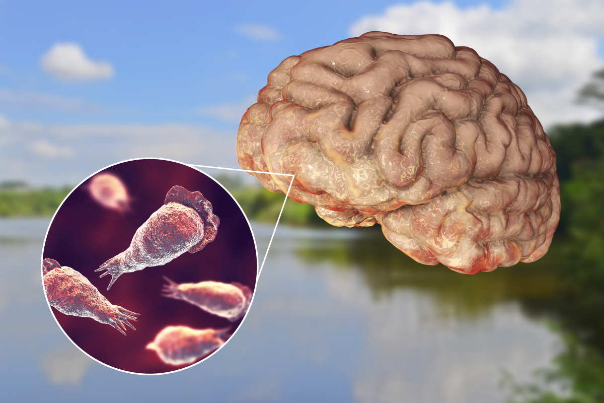 ameba mangia cervello