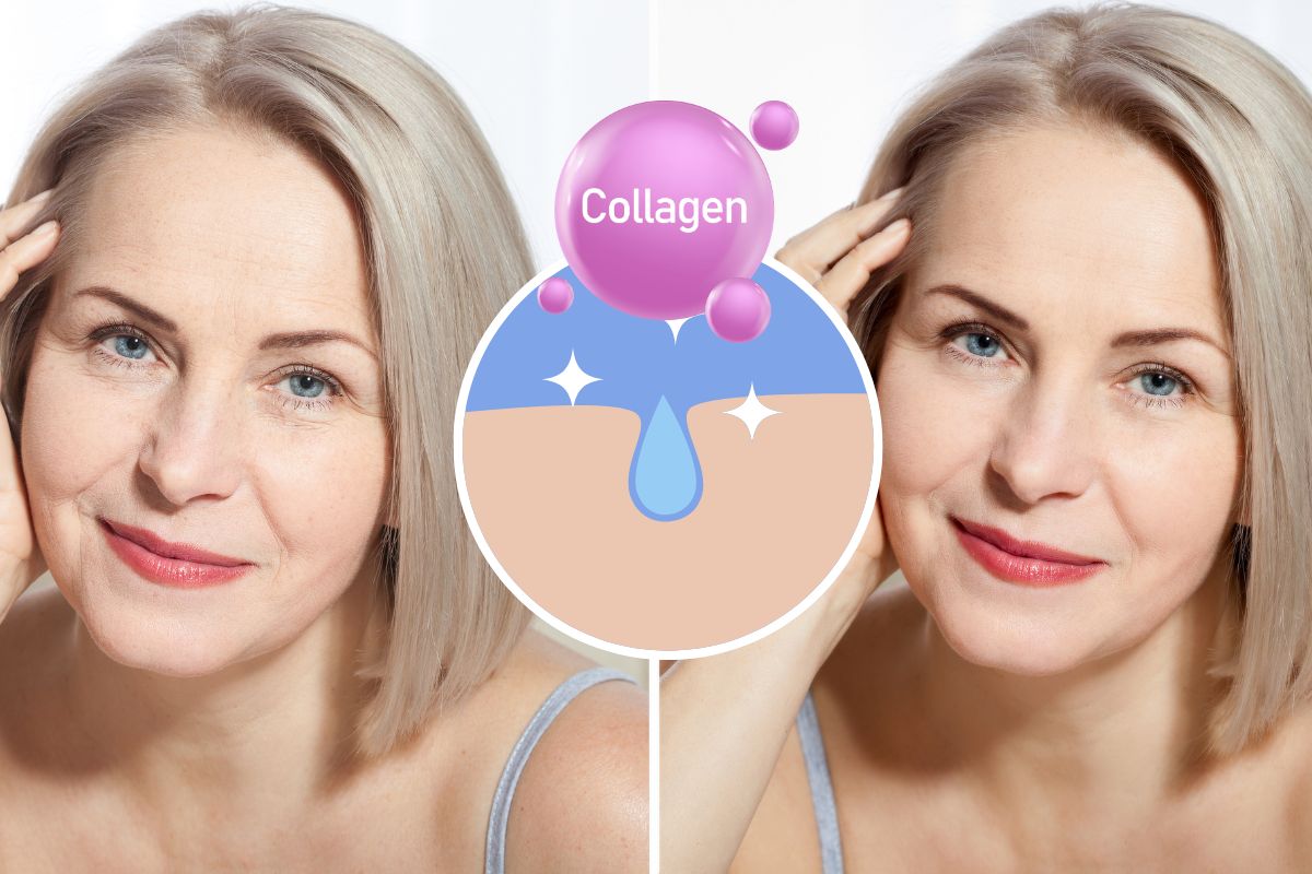 How to Naturally Increase Collagen Levels in Your Body